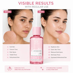 Esteen Skin Care 8NA Whitening Toner with Arbutin & Glutathione